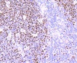 Invitrogen MSH6 Recombinant Rabbit Monoclonal Antibody (JA84-26) 100 &mu;L;