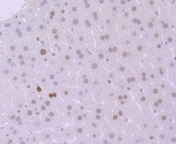 Invitrogen MSH6 Recombinant Rabbit Monoclonal Antibody (JA84-26) 100 &mu;L;
