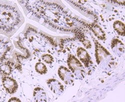 Invitrogen MSH6 Recombinant Rabbit Monoclonal Antibody (JA84-26) 100 &mu;L;