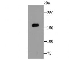 Invitrogen MSH6 Recombinant Rabbit Monoclonal Antibody (JA84-26) 100 &mu;L;