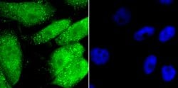 Invitrogen Gata-4 Recombinant Rabbit Monoclonal Antibody (JA11-41) 100