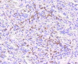 Invitrogen NOXA Recombinant Rabbit Monoclonal Antibody (JA30-03) 100 &mu;L;