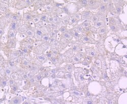 Invitrogen NOXA Recombinant Rabbit Monoclonal Antibody (JA30-03) 100 &mu;L;