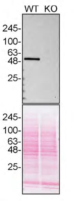 Invitrogen CaMKII delta Recombinant Rabbit Monoclonal Antibody (JA30-07)