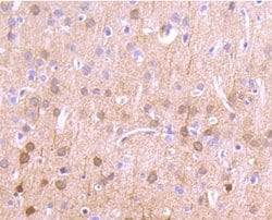 Invitrogen CaMKII delta Recombinant Rabbit Monoclonal Antibody (JA30-07)