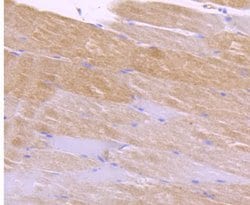 Invitrogen CaMKII delta Recombinant Rabbit Monoclonal Antibody (JA30-07)
