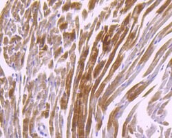 Invitrogen CaMKII delta Recombinant Rabbit Monoclonal Antibody (JA30-07)