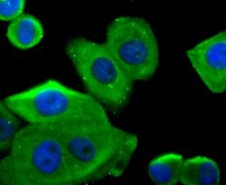 Invitrogen G6PD Recombinant Rabbit Monoclonal Antibody (JA31-40) 100 &mu;L;