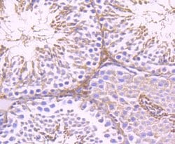 Invitrogen G6PD Recombinant Rabbit Monoclonal Antibody (JA31-40) 100 &mu;L;
