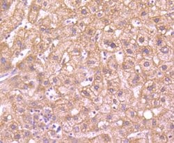 Invitrogen G6PD Recombinant Rabbit Monoclonal Antibody (JA31-40) 100 &mu;L;