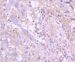 Invitrogen G6PD Recombinant Rabbit Monoclonal Antibody (JA31-40) 100 &mu;L;