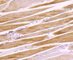 Invitrogen G6PD Recombinant Rabbit Monoclonal Antibody (JA31-40) 100 &mu;L;
