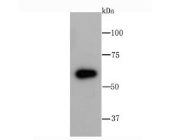 Invitrogen G6PD Recombinant Rabbit Monoclonal Antibody (JA31-40) 100 &mu;L;