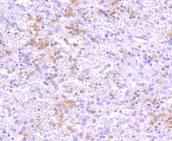 Invitrogen IKK gamma Recombinant Rabbit Monoclonal Antibody (JA11-83) 100