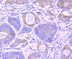 Invitrogen IKK gamma Recombinant Rabbit Monoclonal Antibody (JA11-83) 100