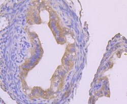 Invitrogen IKK gamma Recombinant Rabbit Monoclonal Antibody (JA11-83) 100