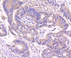 Invitrogen IKK gamma Recombinant Rabbit Monoclonal Antibody (JA11-83) 100