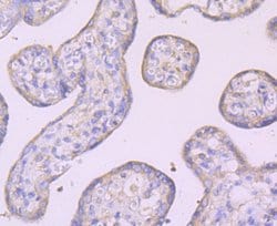 Invitrogen IKK gamma Recombinant Rabbit Monoclonal Antibody (JA11-83) 100