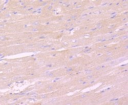 Invitrogen IKK gamma Recombinant Rabbit Monoclonal Antibody (JA11-83) 100
