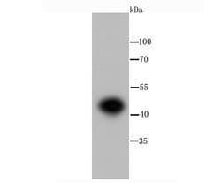 Invitrogen IKK gamma Recombinant Rabbit Monoclonal Antibody (JA11-83) 100