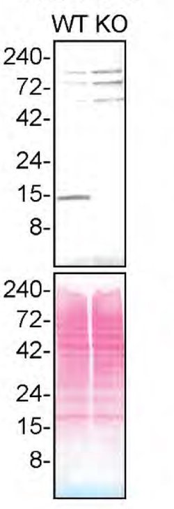 Invitrogen Profilin 1 Recombinant Rabbit Monoclonal Antibody (JA30-13)