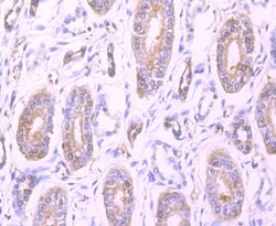 Invitrogen Profilin 1 Recombinant Rabbit Monoclonal Antibody (JA30-13)