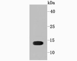 Invitrogen Profilin 1 Recombinant Rabbit Monoclonal Antibody (JA30-13)
