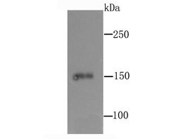 Invitrogen CD163 Recombinant Rabbit Monoclonal Antibody (JA51-30) 100 &mu;L;