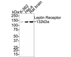 Invitrogen Leptin Receptor Recombinant Rabbit Monoclonal Antibody (JA73-01) 100 &mu;L | Buy Online | Invitrogen&trade; | Fisher Scientific