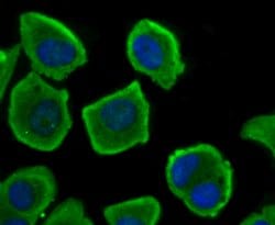 NFATC1 Recombinant Rabbit Monoclonal Antibody (JA81-03), Invitrogen 100