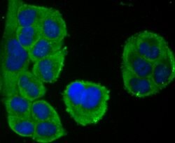 NFATC1 Recombinant Rabbit Monoclonal Antibody (JA81-03), Invitrogen 100