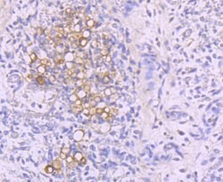 NFATC1 Recombinant Rabbit Monoclonal Antibody (JA81-03), Invitrogen 100