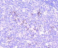 NFATC1 Recombinant Rabbit Monoclonal Antibody (JA81-03), Invitrogen 100