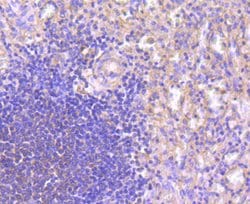 NFATC1 Recombinant Rabbit Monoclonal Antibody (JA81-03), Invitrogen 100