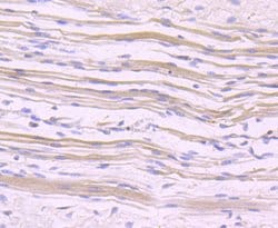 NFATC1 Recombinant Rabbit Monoclonal Antibody (JA81-03), Invitrogen 100