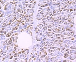 Invitrogen LPL Recombinant Rabbit Monoclonal Antibody (JA22-02) 100 &mu;L | Buy Online | Invitrogen&trade; | Fisher Scientific
