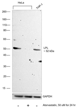 Invitrogen LPL Recombinant Rabbit Monoclonal Antibody (JA22-02) 100 &mu;L | Buy Online | Invitrogen&trade; | Fisher Scientific