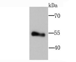 Invitrogen LPL Recombinant Rabbit Monoclonal Antibody (JA22-02) 100 &mu;L | Buy Online | Invitrogen&trade; | Fisher Scientific