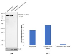 Invitrogen Clathrin Heavy Chain Recombinant Rabbit Monoclonal Antibody (JA53-02) 100 &mu;L | Buy Online | Invitrogen&trade; | Fisher Scientific