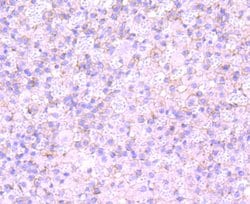 Invitrogen Clathrin Heavy Chain Recombinant Rabbit Monoclonal Antibody (JA53-02) 100 &mu;L | Buy Online | Invitrogen&trade; | Fisher Scientific
