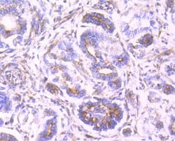 Invitrogen Clathrin Heavy Chain Recombinant Rabbit Monoclonal Antibody (JA53-02) 100 &mu;L | Buy Online | Invitrogen&trade; | Fisher Scientific