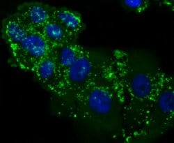 Invitrogen LXR alpha Recombinant Rabbit Monoclonal Antibody (JA20-38) 100
