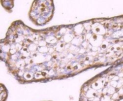 Invitrogen LXR alpha Recombinant Rabbit Monoclonal Antibody (JA20-38) 100