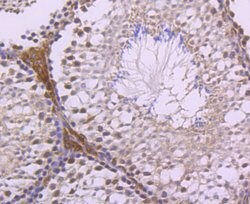 Invitrogen LXR alpha Recombinant Rabbit Monoclonal Antibody (JA20-38) 100