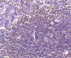 Invitrogen LXR alpha Recombinant Rabbit Monoclonal Antibody (JA20-38) 100