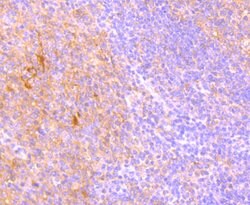 Invitrogen TRAIL-R2 (DR5) Recombinant Rabbit Monoclonal Antibody (JA03-38)