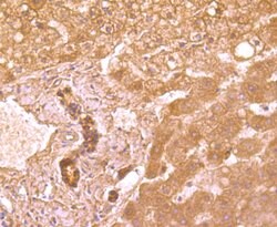 Invitrogen TRAIL-R2 (DR5) Recombinant Rabbit Monoclonal Antibody (JA03-38)