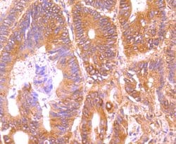 Invitrogen TRAIL-R2 (DR5) Recombinant Rabbit Monoclonal Antibody (JA03-38)