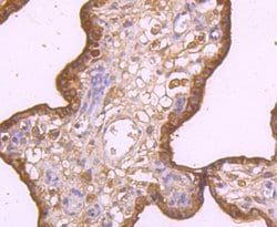 Invitrogen TRAIL-R2 (DR5) Recombinant Rabbit Monoclonal Antibody (JA03-38)
