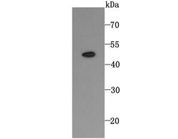 Invitrogen TRAIL-R2 (DR5) Recombinant Rabbit Monoclonal Antibody (JA03-38)